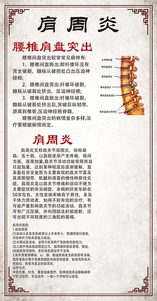中国风肩周炎宣传海报